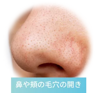 鼻や頬の毛穴の開き