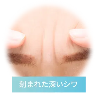 刻まれた深いシワ