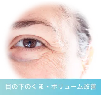 目の下のくま・ボリューム改善