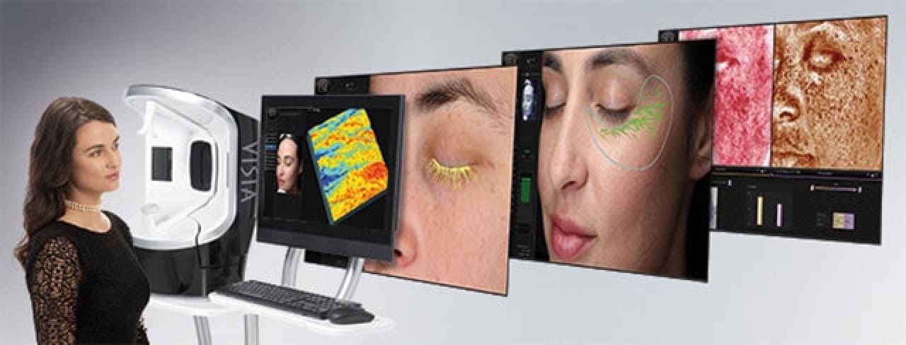 肌診断VISIA